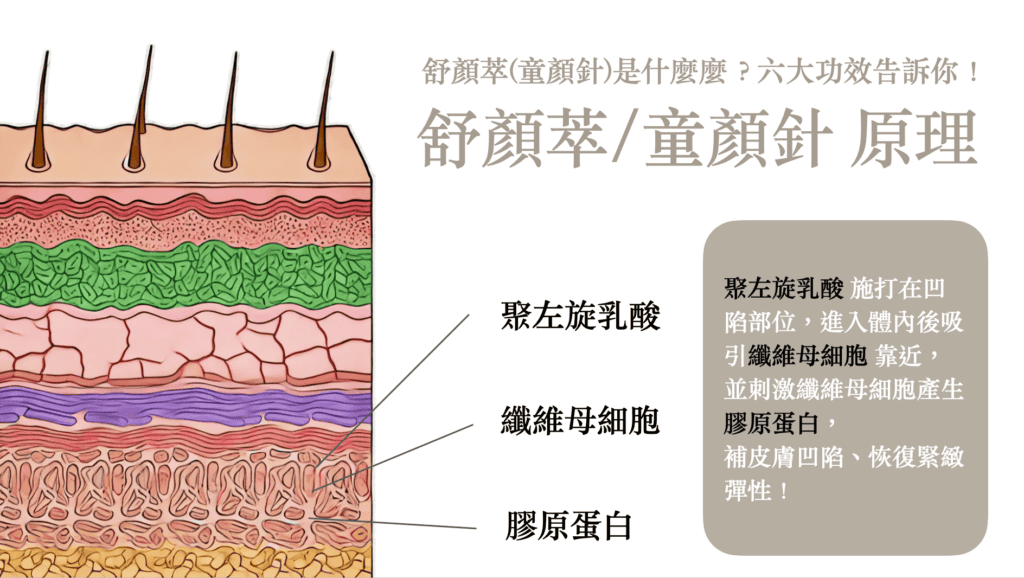 舒顏萃/童顏針是什麼？