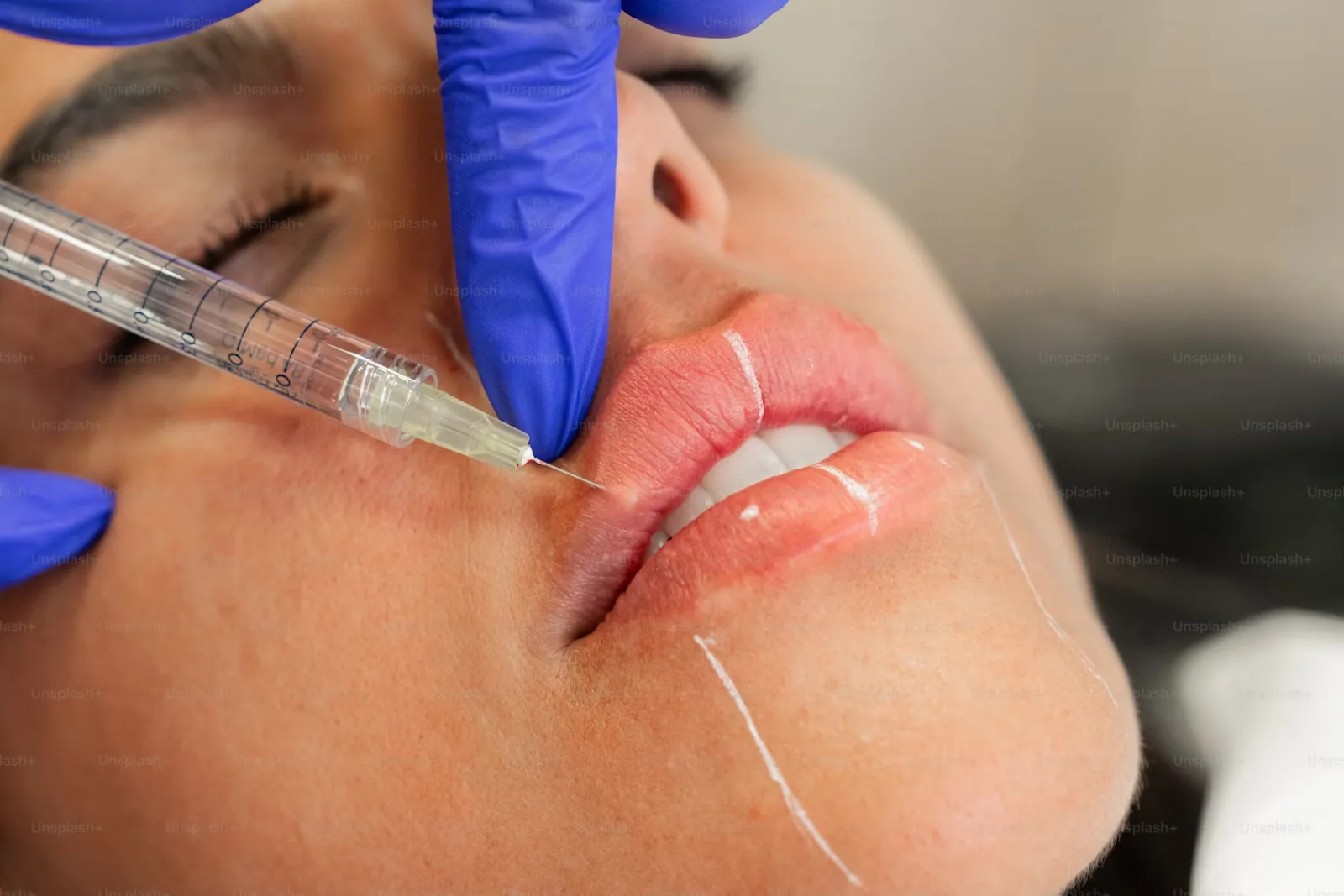 玻尿酸 Hyaluronic Acid 是什麼?