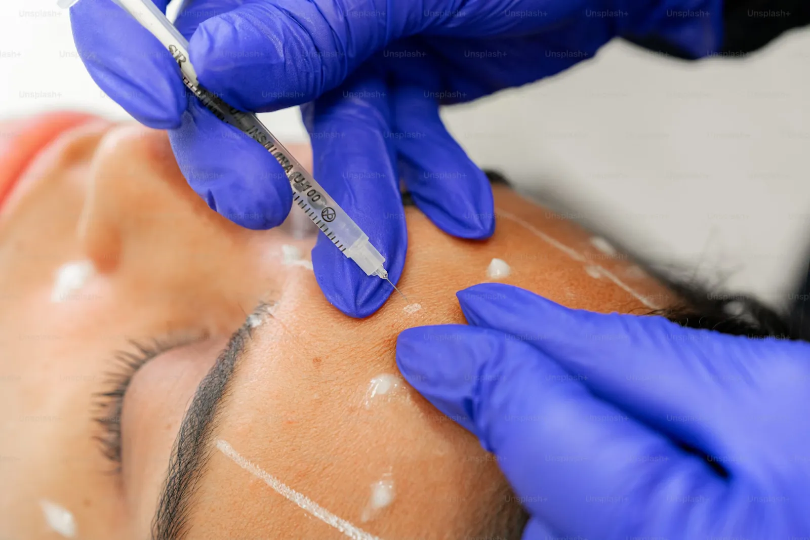 打肉毒到底安不安全？關鍵在這5件事